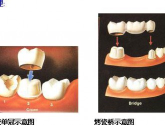 口腔治療中的騙局都有哪些？這些坑不要踩！