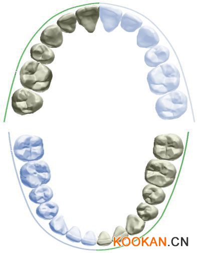 海量個(gè)性化美學(xué)弓形數(shù)據(jù)