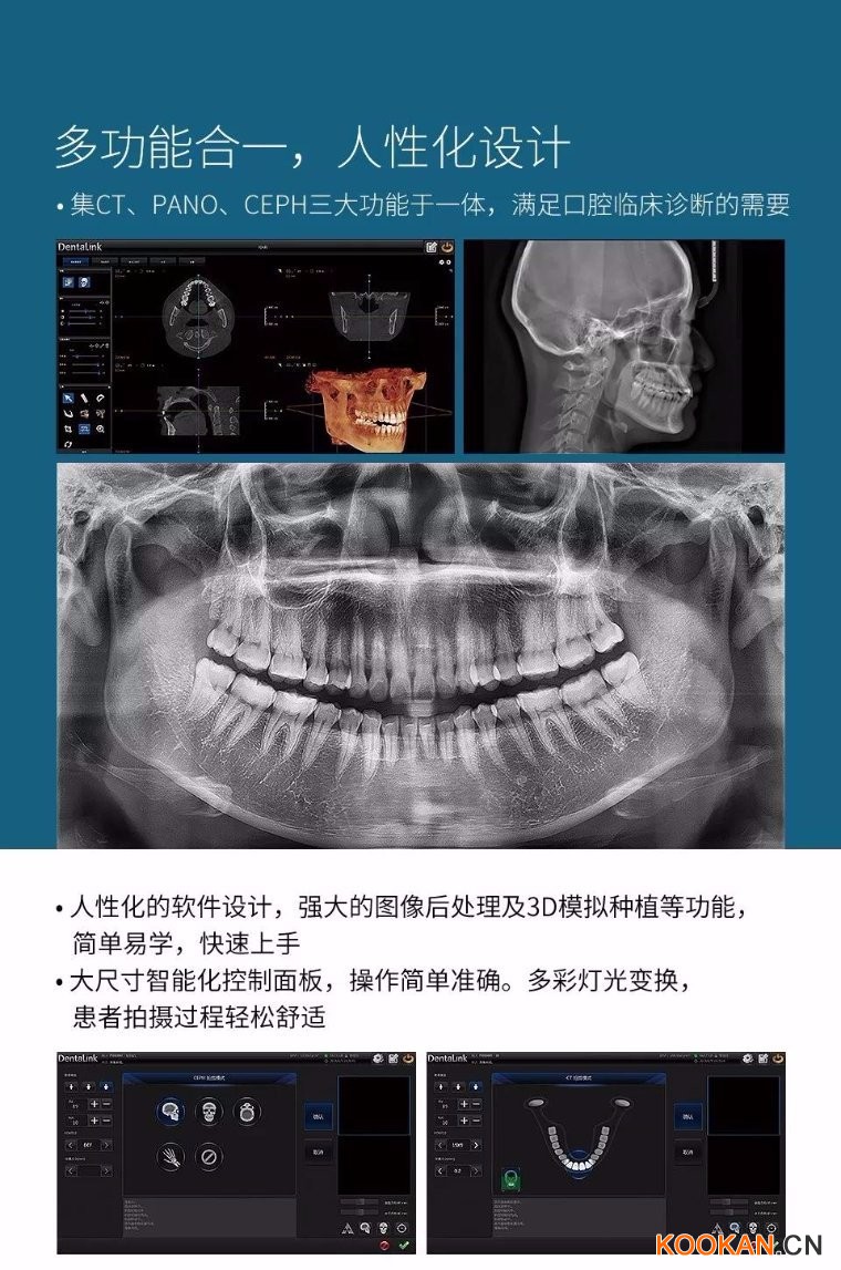 菲森CBCT多功能合一，人性化設(shè)計