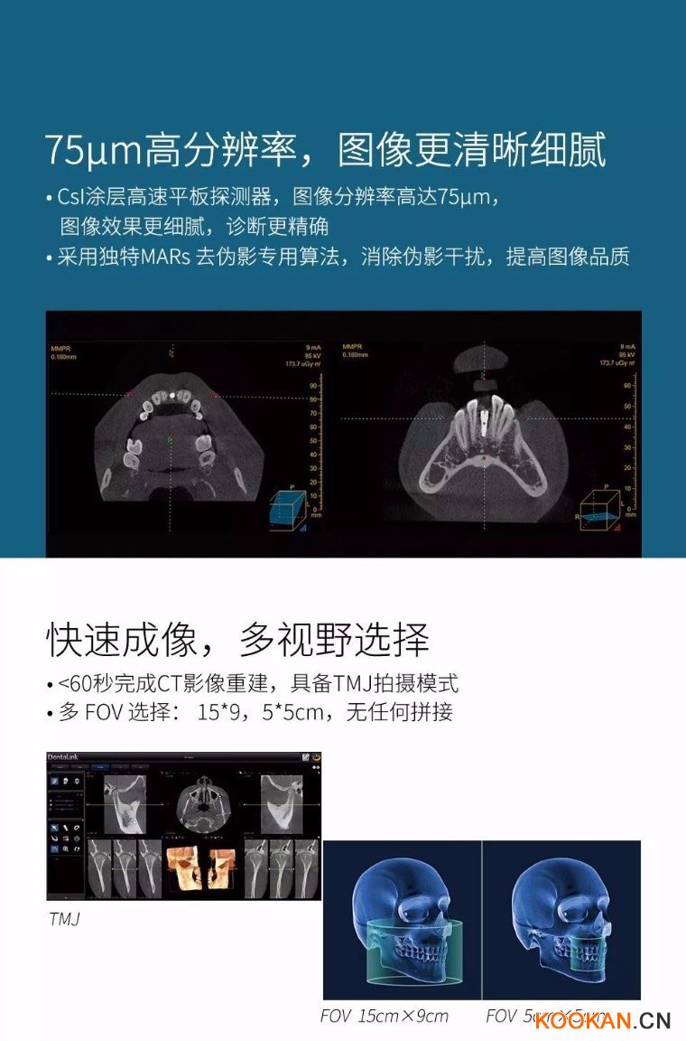 菲森CBCT拍攝影像圖像清晰細(xì)膩