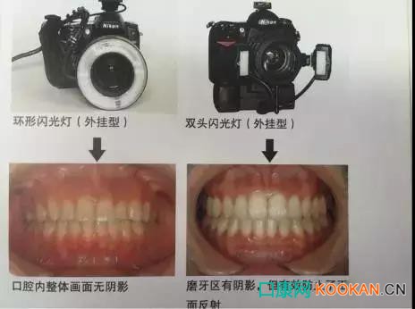 拍不好口腔照片怎么辦？這些口腔攝影方法與技巧請收好！