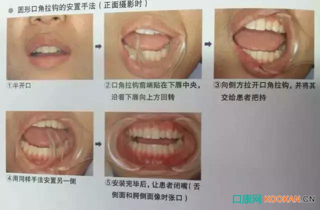 拍不好口腔照片怎么辦？這些口腔攝影方法與技巧請收好！