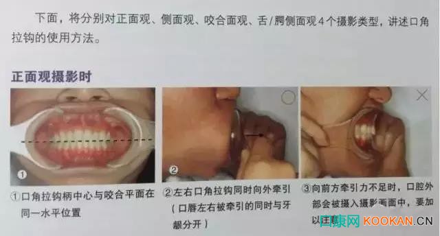 拍不好口腔照片怎么辦？這些口腔攝影方法與技巧請收好！