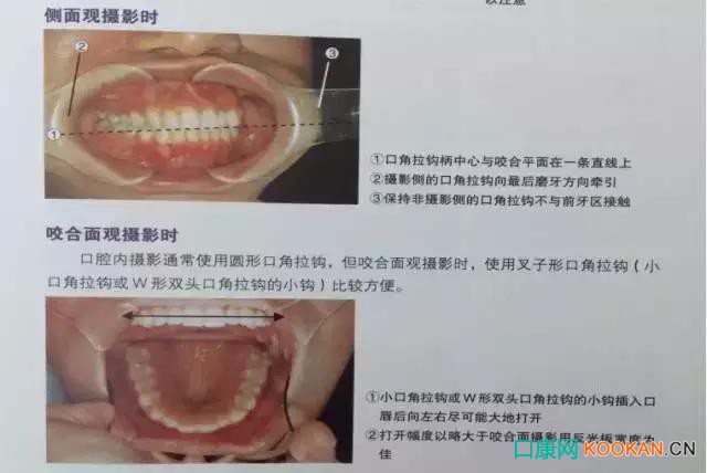 拍不好口腔照片怎么辦？這些口腔攝影方法與技巧請收好！