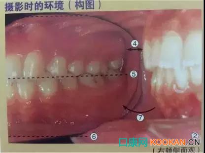 拍不好口腔照片怎么辦？這些口腔攝影方法與技巧請收好！