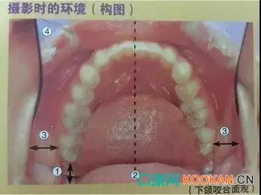 拍不好口腔照片怎么辦？這些口腔攝影方法與技巧請收好！