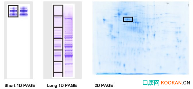 百泰派克2D SDS-PAGE示例